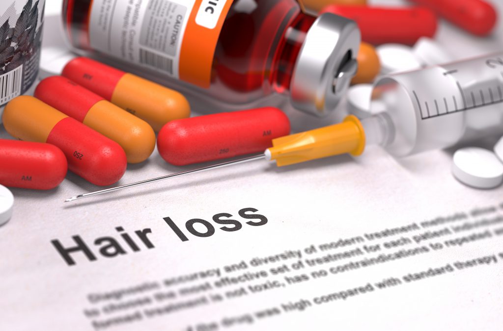 hair loss caused by hormonal imbalance 