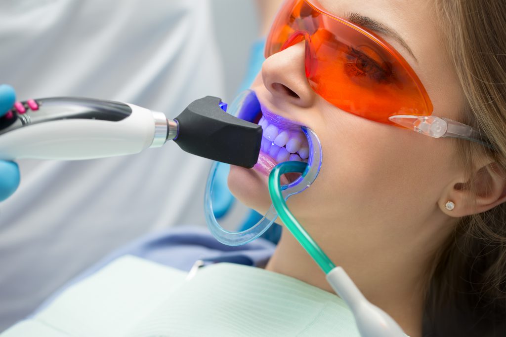 laser teeth whitening in qatar, dentists