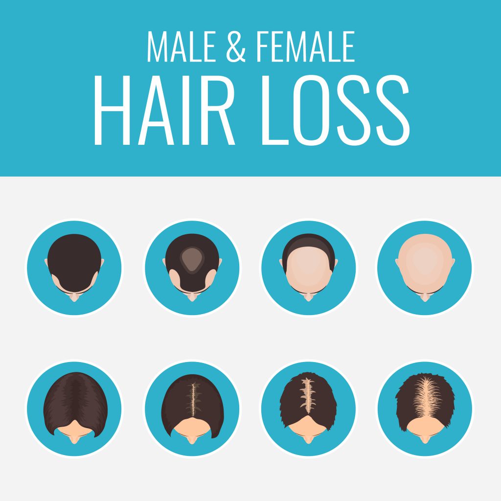 hair loss occurs mostly in men than women in different areas
