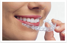 invisalign qatar braces type consultant dental center 