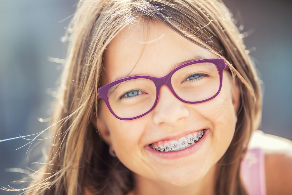 5 Signs You May Need Braces