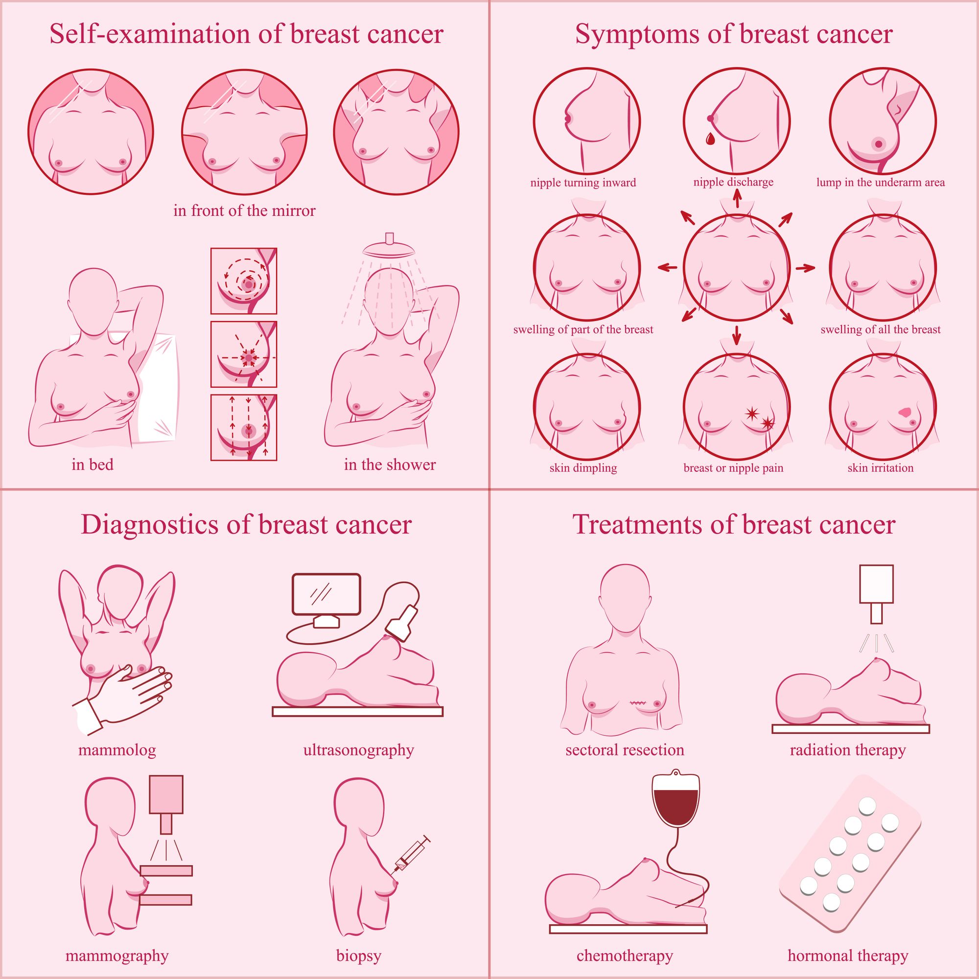 Chart showing the symptoms, self-examination method, diagnosis and treatment of breast cancer for awareness.