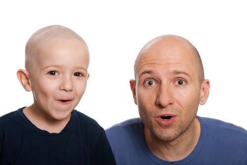 Bald father and son surprised.