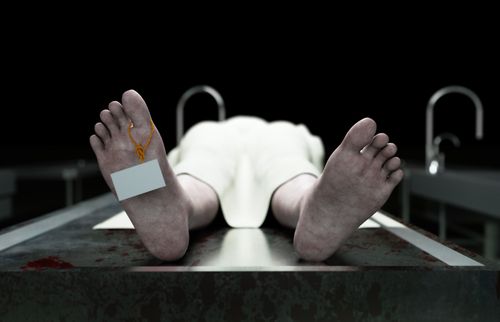 Image of a corpse with a name tag attached.